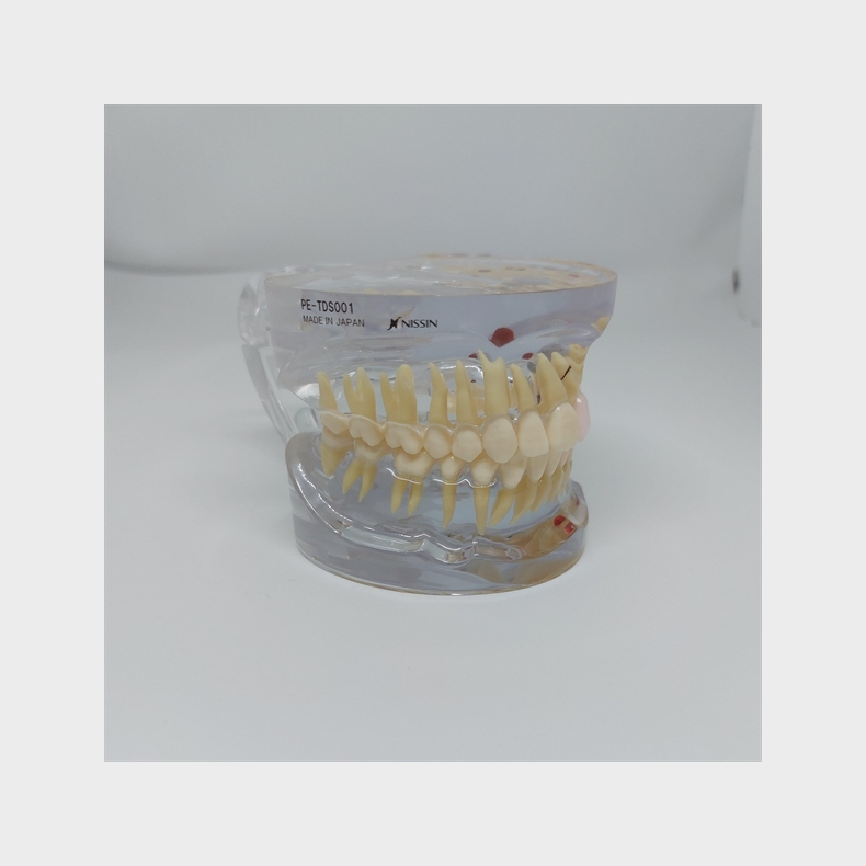 Transparent Sygdomsmodel